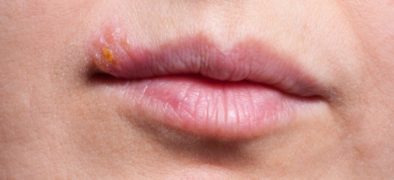 View of Image result for pregnant women and sashimi risks