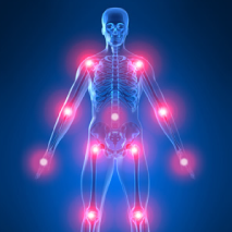 Doenças Neuromusculares