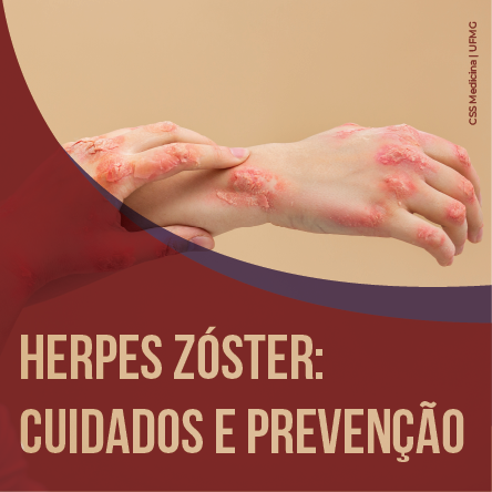 Herpes Zóster: cuidados e prevenção