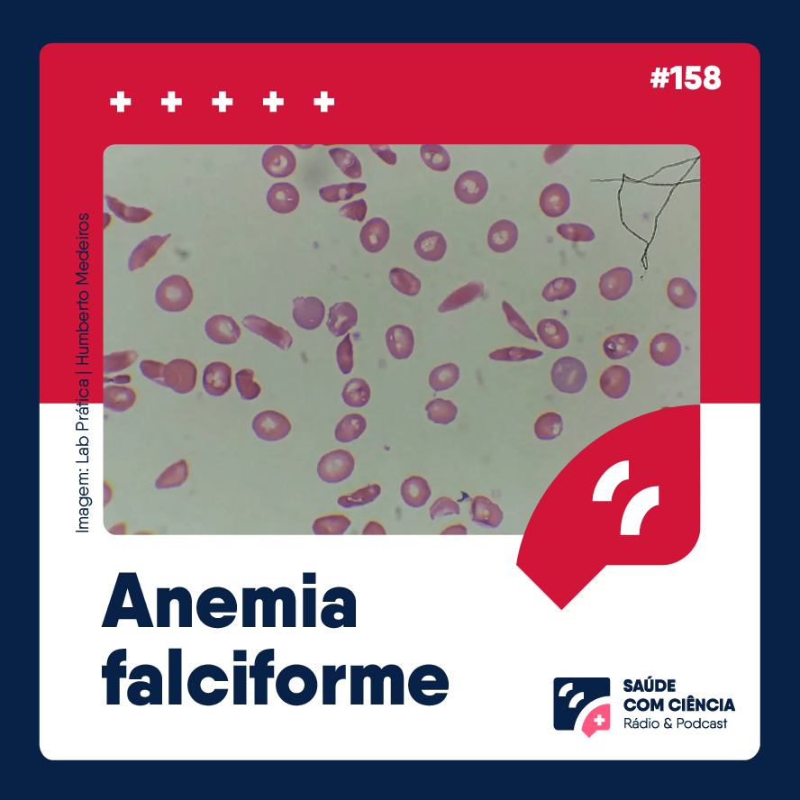Anemia falciforme