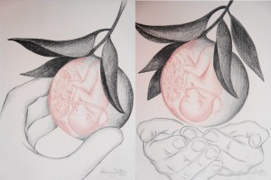 Ilustração "compara" cesárea e parto normal. Crédito: blogpalavrademae.files.wordpress.com