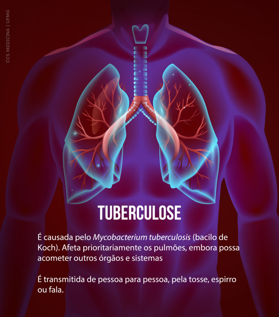 Como curar a tuberculose, em RDR 2: há uma cura para a doença?